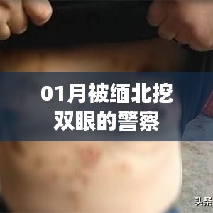 緬北警察遭遇暴力襲擊，雙眼被挖事件回顧