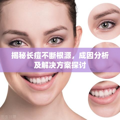 揭秘長痘不斷根源，成因分析及解決方案探討